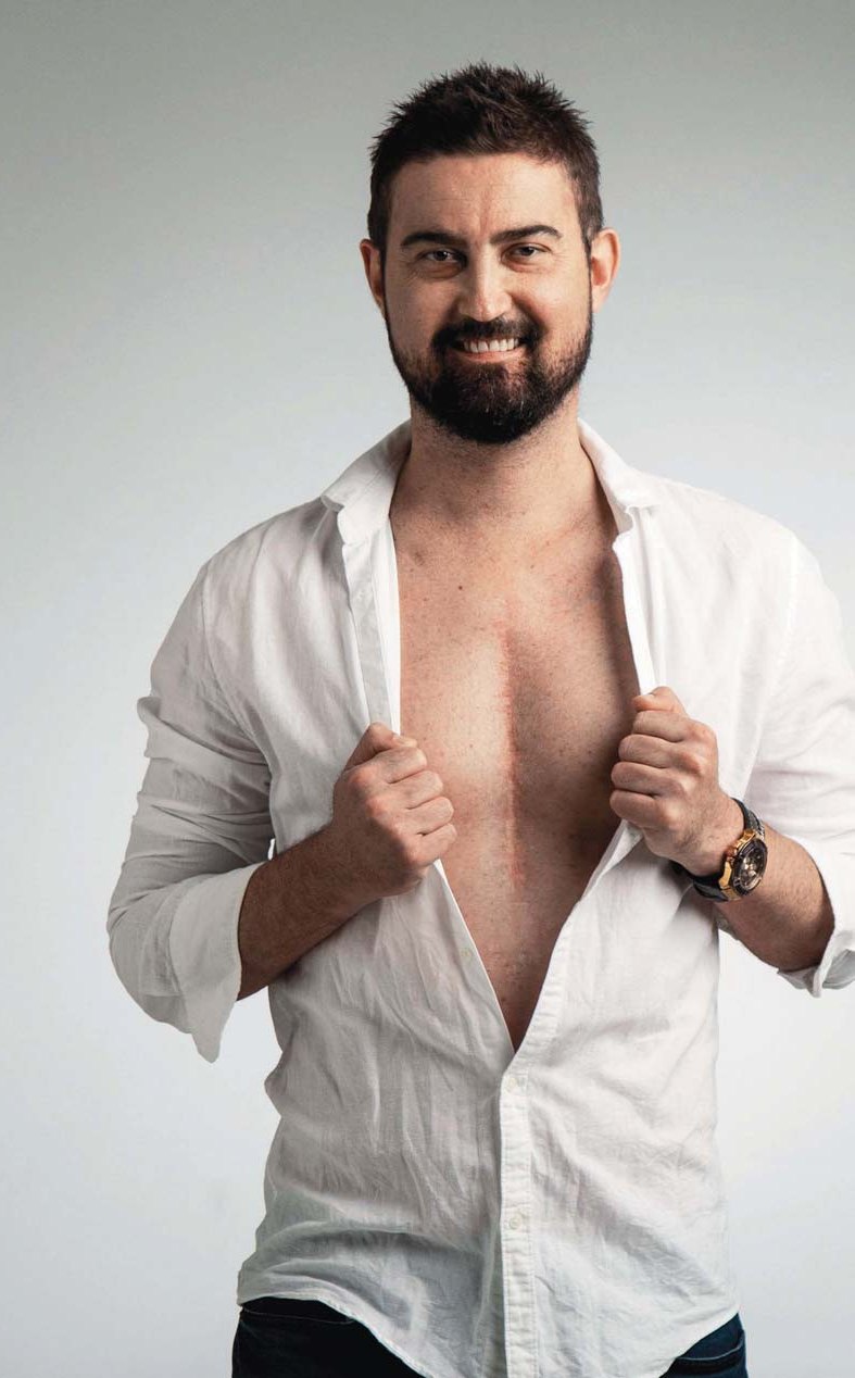 Damien Thompson opening his shirt to show the scars from his surgeries